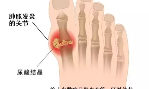 哺乳期吃啥补铁补血网 - 网站提供哺乳期吃补铁补血药对宝宝有影响吗小常识、哺乳期补铁吃什么牌子比较好
